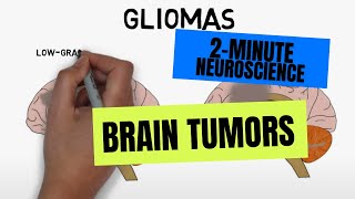 2Minute Neuroscience Brain tumors [upl. by Calabrese]