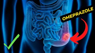 Omeprazole An In Depth Guide To Its Uses Benefits And Side Effects [upl. by Rednaeel]