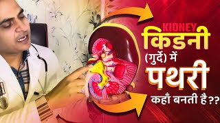 FullVideo👉HUMAN KIDNEY amp KIDNEY STONE  किडनीगुर्दे अंदर से कैसी होती है और इसमें पथरी कहाँ बनती है [upl. by Yro]