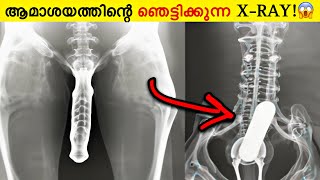 10 Strangest Things Discovered By XRays [upl. by Jo-Ann]