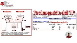 EVALUACIÓN DE LA PROLONGACIÓN DEL TP DEFICIENCIA DEL FACTOR VII [upl. by Zhang]