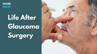 Life After Glaucoma Surgery [upl. by Hilaria]