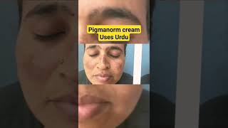 Pigmanorm cream Uses in urduHindi  Pigmanorm whitening cream  pigmanorm cream  Dr Nadeem [upl. by Tuchman]