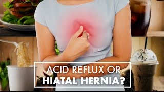 Acid Reflux or Hiatal Hernia  Dr Gary Alexander  Top10MD [upl. by Aninnaig329]