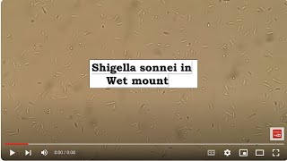 Shigella sonnei in Wet mount Microscopy [upl. by Morse]