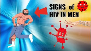 First Sign of HIV in Man [upl. by Gallager]