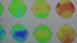 Chris Performs QEEG Brain Mapping at Health Show [upl. by Ahseina818]