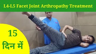 L4L5 Facet Joint Arthropathy Treatment in 15 Days  Slip Disc treatment by dr mukesh sharma [upl. by Kelsi431]