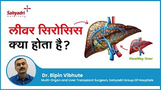 लीवर सिरोसिस क्या होता है  Liver Cirrhosis In Hindi  Dr Bipin Vibhute Sahyadri Hospitals Pune [upl. by Kerrin57]