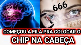 URGENTE CHIP NA CABEÇA COMEÇOU A FILA PARA A IMPLANTAÇÃO DE MICROCHIP NO CÉREBRO HUMANO [upl. by Mignonne]