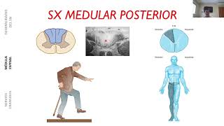 SÍNDROMES MEDULARES [upl. by Nylareg]