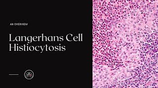 What is Langerhans Cell Histiocytosis [upl. by Dugaid316]