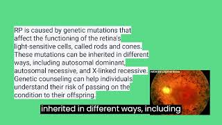 Retinitis Pigmentosa  ophthalmology [upl. by Mohsen216]