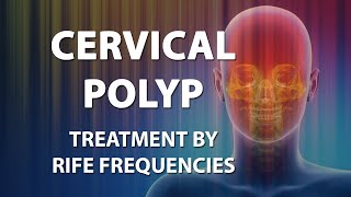 Cervical Polyp  RIFE Frequencies Treatment  Energy amp Quantum Medicine with Bioresonance [upl. by Corette855]