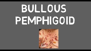 Bullous pemphigoid [upl. by Gilchrist]