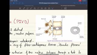 Prolapsed Intervertebral Disc PIVD Stages Clinical features Examination and Treatment [upl. by Mellar]