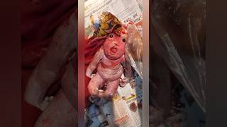 Miracle Baby anencephaly baby Without Most of His Brain Defying Odds  shorts viral trending [upl. by Leerzej]