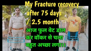 My fracture recovery after 75 days  25 month।। आज फुल वेट डाल कर वॉकर से चला बहुत अच्छा लगा।। [upl. by Huntlee]