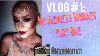 VLOG 1 Diary of a Bald Barbie my alopecia journey  part one [upl. by Eicarg]