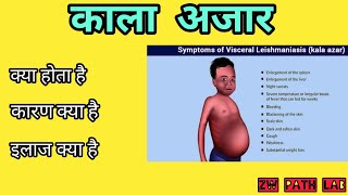 कला अजार  क्या है।। कारण और इलाज ।। [upl. by Siclari389]