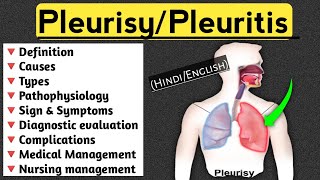 PleurisyPleuritis lecture in Hindi and English medical nursingcriteria pleuritis paramedical [upl. by Kile697]