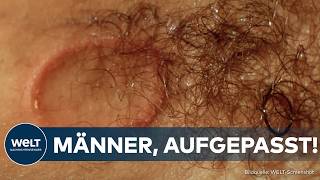 PILZ IN BARBERSHOPS Männer aufgepasst Immer mehr Kunden haben nach ihrem Friseurbesuch Hautpilz [upl. by Einnij]