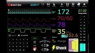 EKG Simulator  ECG Simulator [upl. by Aldora965]