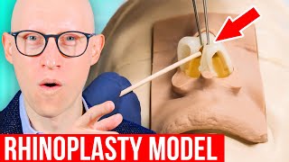 RHINOPLASTY Explained by Plastic Surgeon [upl. by Ahsietal618]