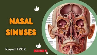 2  Head amp Neck Imaging for FRCR [upl. by Konrad]