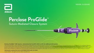 US Small Hole ProGlide™ Deployment Video [upl. by Nahshun692]