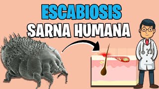 SARNA HUMANA  ESCABIOSIS sintomas TRATAMIENTO 2023  Sarcoptes Scabiei ✅ [upl. by Shakti]