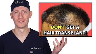 10 Reasons  Do Not Get A Hair Transplant  Hair Surgeon Reacts [upl. by Aliber538]