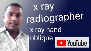 x ray hand oblique view  x ray hand oblique position  x ray hand [upl. by Neret]