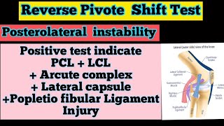 Reverse PivotShift TestPosterolateral Rotatory Instability of the KneeEverything You Need To Know [upl. by Rox]