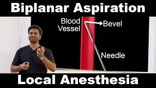 Biplanar Aspiration during Nerve Block [upl. by Ocramed]