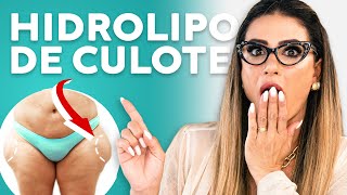 HIDROLIPO DE CULOTE  LILI SPADA [upl. by Immij]