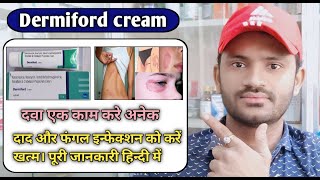 Dermiford cream use benefits and Side effects full review in hindi [upl. by Tterrab]