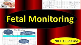 Fetal Monitoring in Labor NICE Guideline 2022  Updates in Cardiotocography CTG [upl. by Essiralc]