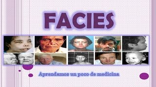 Tipos de facies [upl. by Ayian]