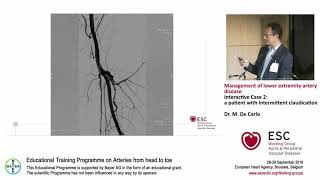 M De Carlo Interactive Case 2 a patient with intermittent claudication [upl. by Norb]