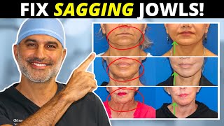 Sagging Jowls 101 How they form and what to do about them tighten and eliminate [upl. by Ibur338]