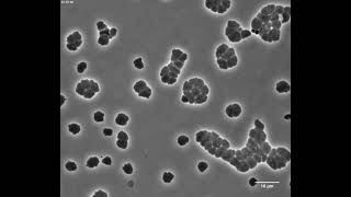 Cholera bacteria can survive antibiotics for a time by turning into globs [upl. by Eitsrik]