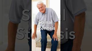 What Causes Spinal Stenosis [upl. by Arihay]