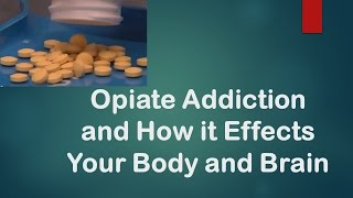 How Opiate Addiction Happens and How To Recover [upl. by Akemej]