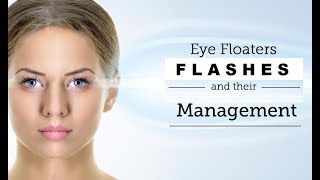 Eye Floaters amp Flashes How to get rid out of this Hindi [upl. by Ajiam842]