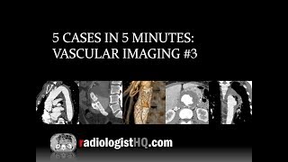 5 Cases in 5 Minutes Vascular 3 [upl. by Kwang]