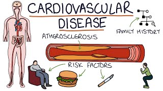 Understanding Cardiovascular Disease Visual Explanation for Students [upl. by Elrem323]