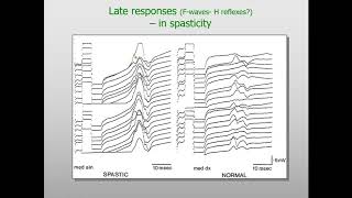 FWave AReflex and HReflex Lecure [upl. by Assenal]