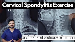 Exercises for cervical spondylitis  Cervical spondylosis exercise in hindi  gardan ki exercise [upl. by Arianna906]