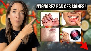 CES 11 SIGNES montrent que votre CORPS MANQUE DE NUTRIMENTS ESSENTIELS naturopathie [upl. by Torey]